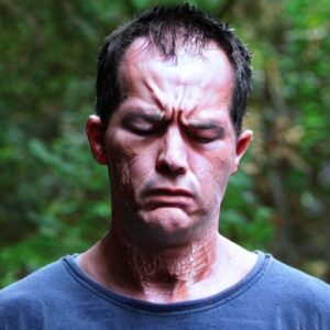 can-sunscreen-cause-a-prickly-heat-rash